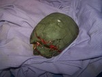this turtle was brought to me by fish and game after some sick kids beat her with a base ball bat. I thought she was going to have to put down